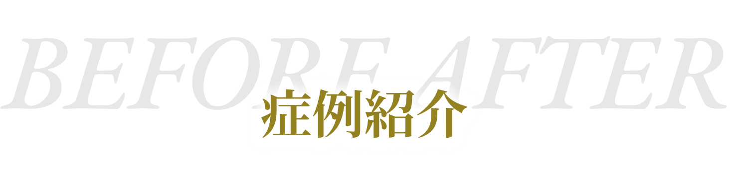 BEFORE AFTER 症例紹介